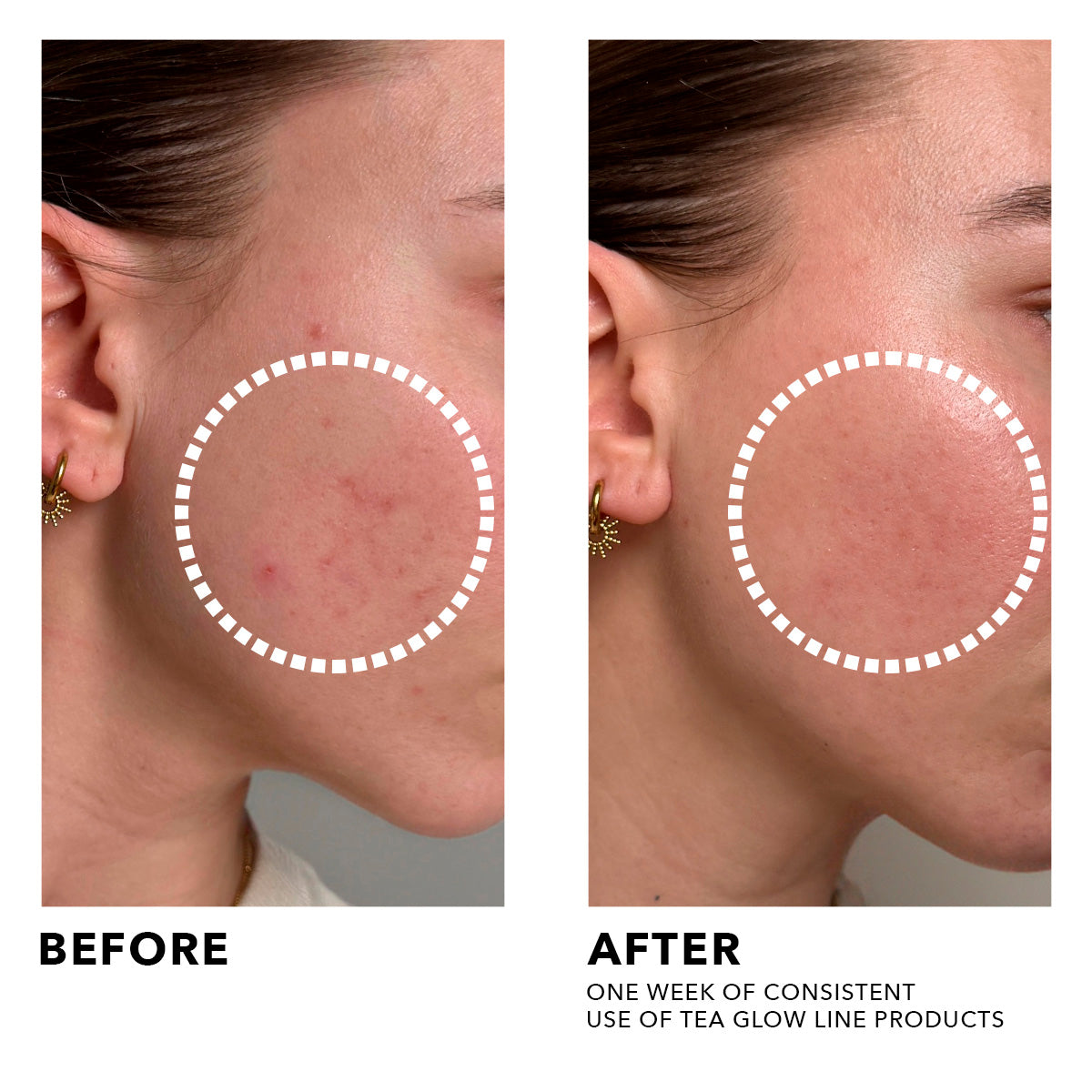 Tea Glow - Scrub Esfoliante viso anti-imperfezioni