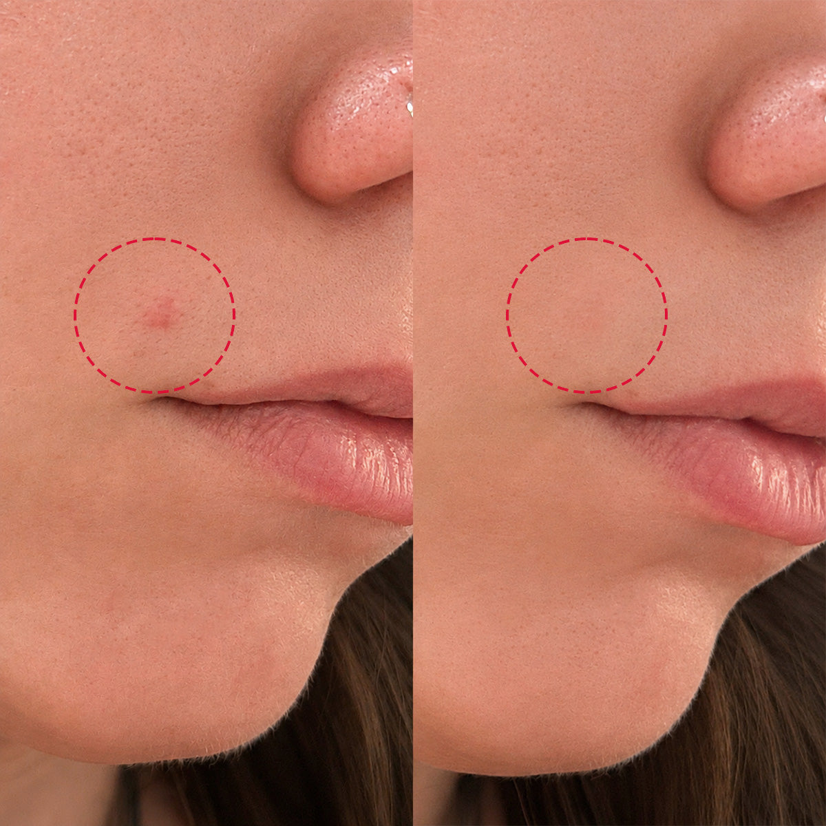 Prima e dopo l'utilizzo dello stick per correggere dopo 24h