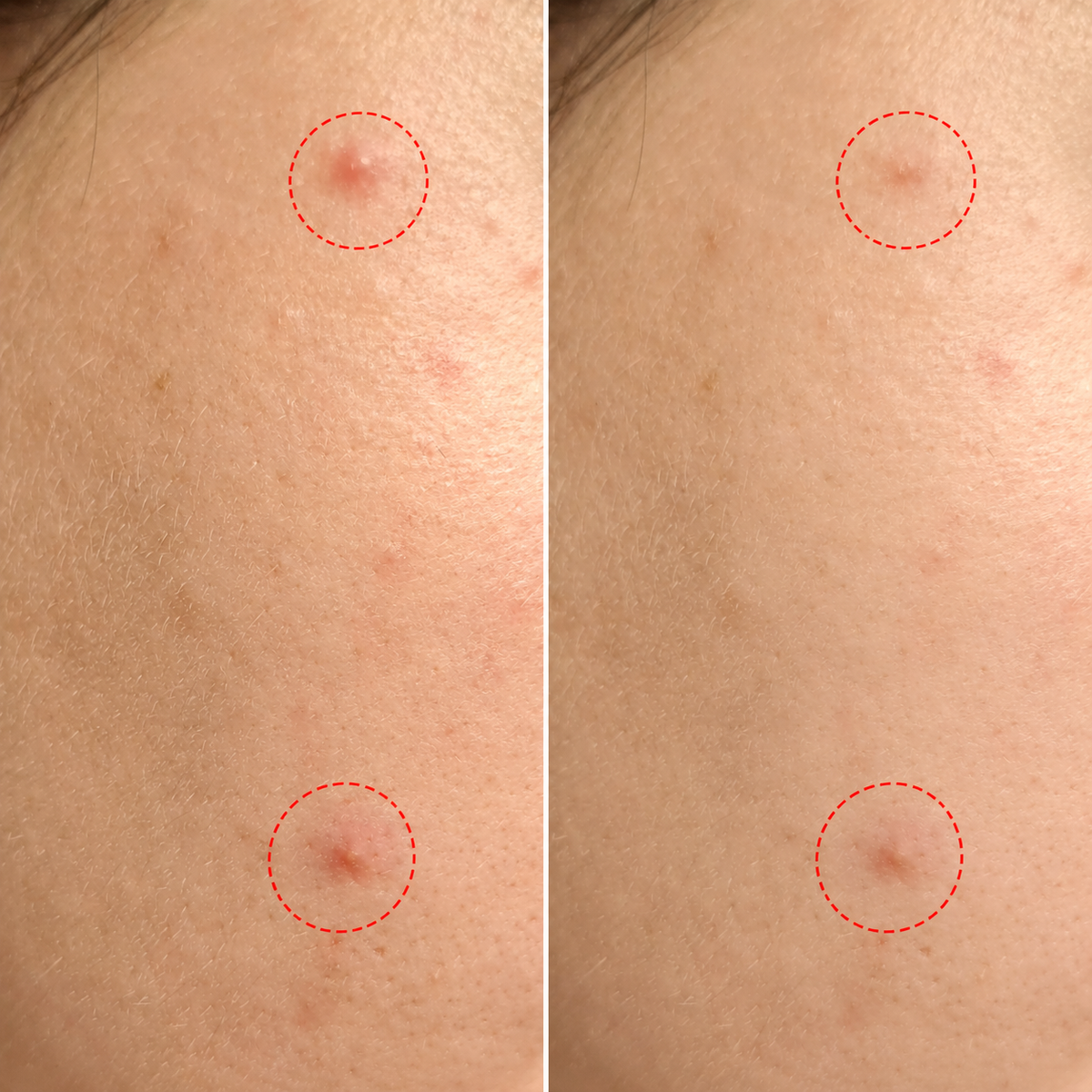 Tea Glow Blemish Tinted Stick | Sztyft korygujący niedoskonałości