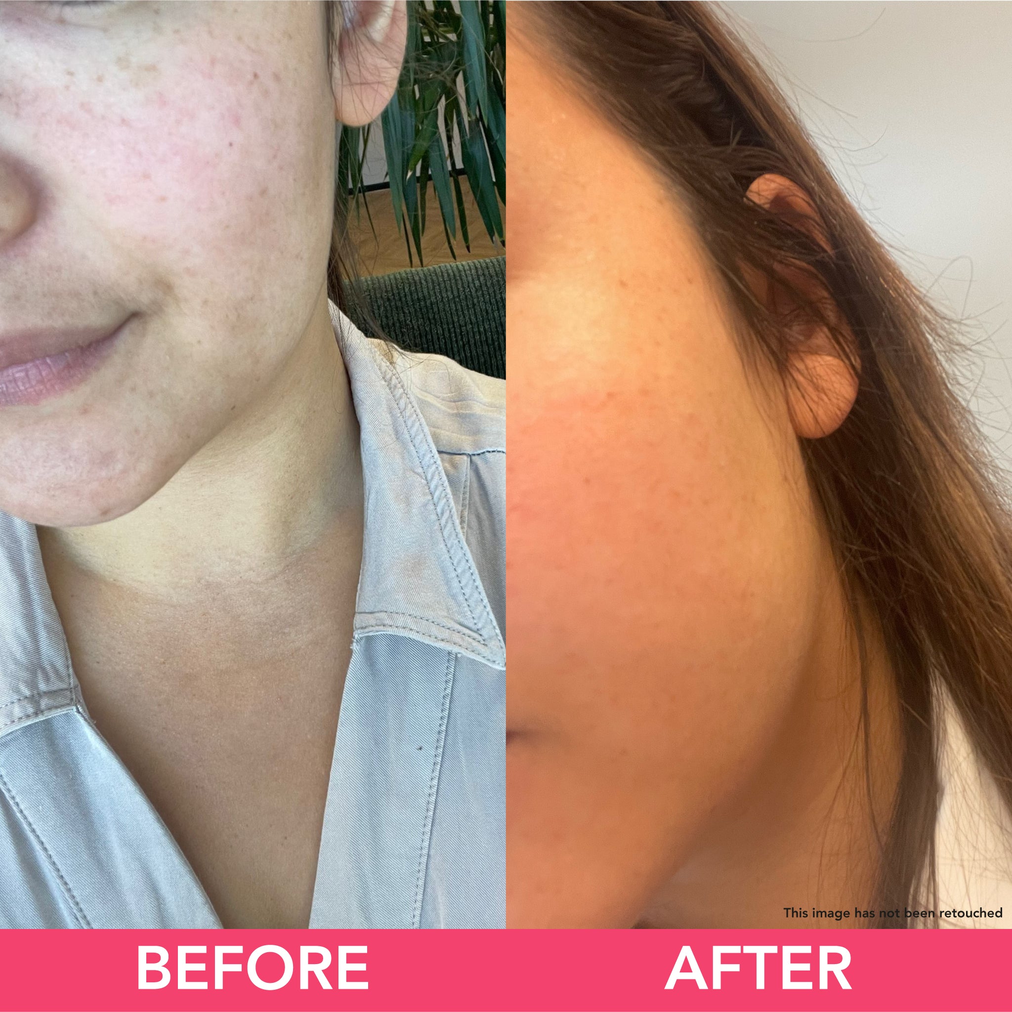 prima e dopo l'utilizzo dello scrub crema-burro viso con estratto di Tè verde Bio, foglie di tè e cristalli di zucchero ad azione detossinante e illuminante.