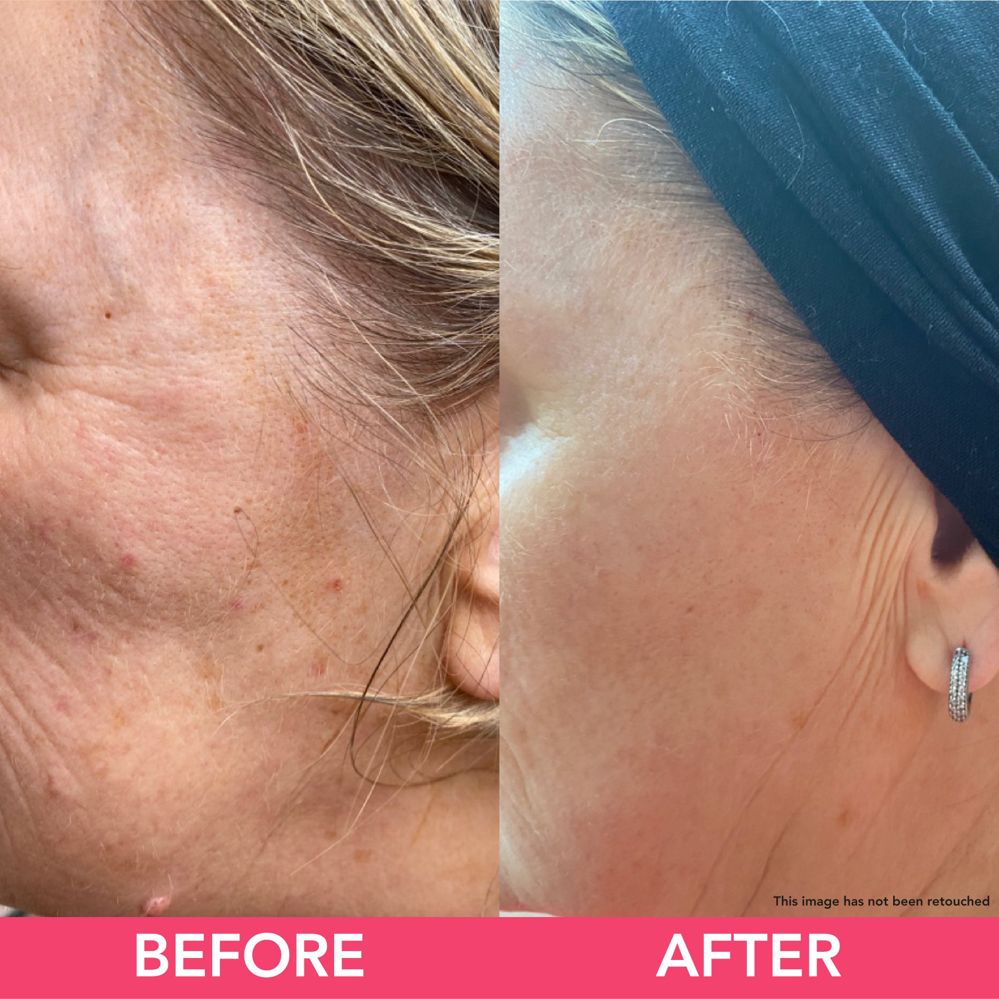 White Tea Miracle Anti-Aging Eye Cream with Peptides