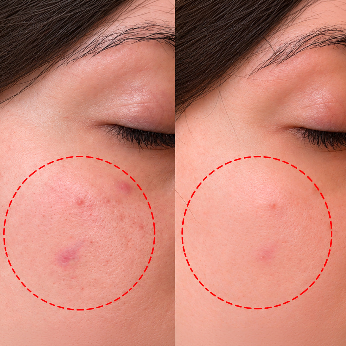 Tea Glow Blemish Tinted Stick | Sztyft korygujący niedoskonałości