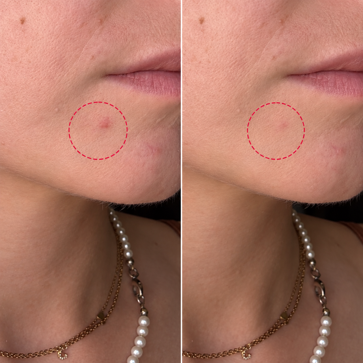Tea Glow Blemish Tinted Stick | Sztyft korygujący niedoskonałości