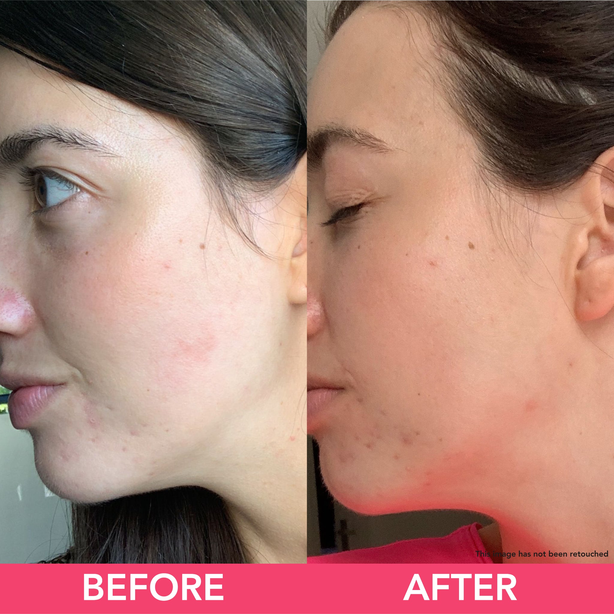 Prima e dopo l'utilizzo di Peach Tea Latte - Olio Detergente Struccante per Viso e Occhi con infuso di Tè Blu, Prebiotici, olio di semi di Tè, Niacinamide. 