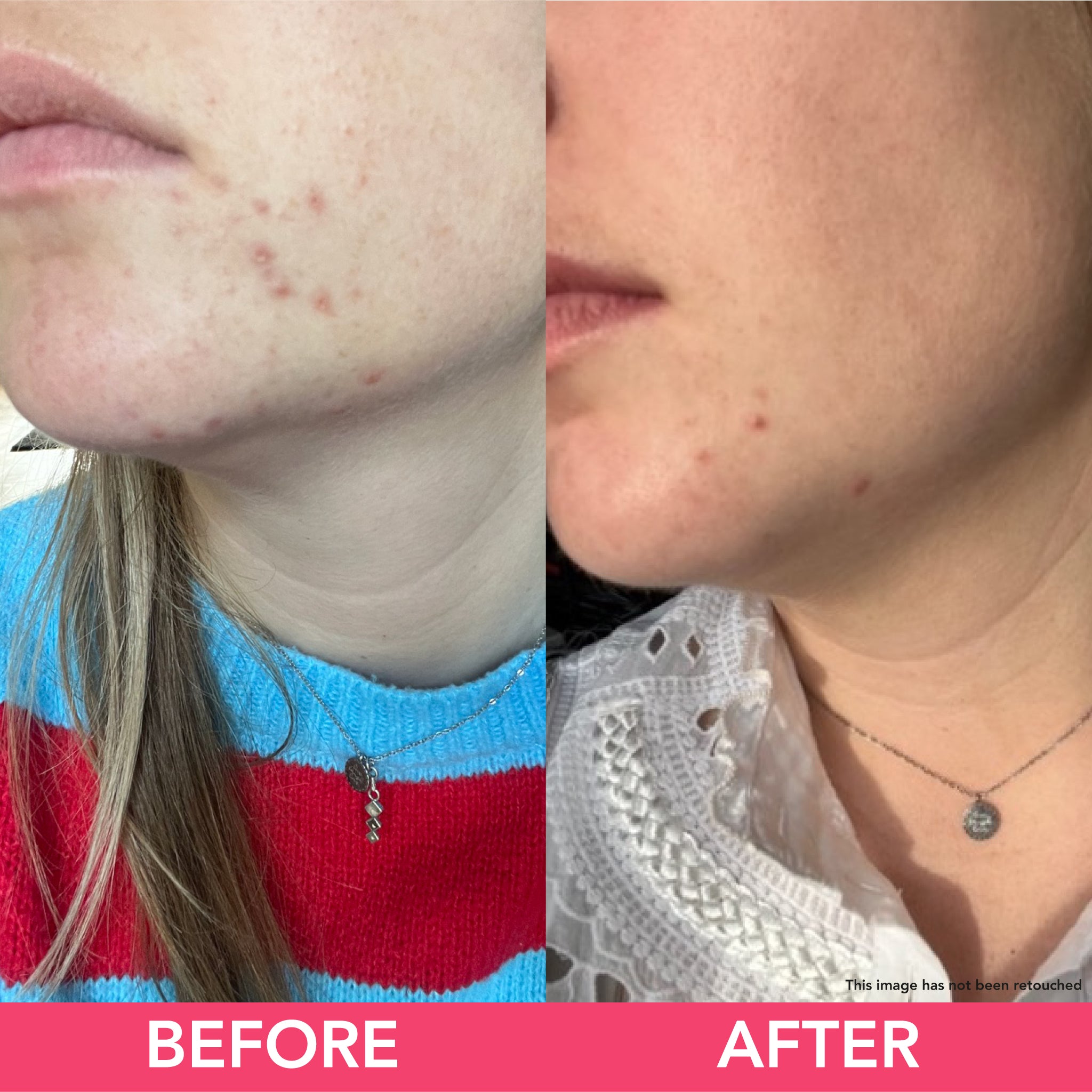 Tea Glow Foam - Exfoliating Facial Cleansing Foam